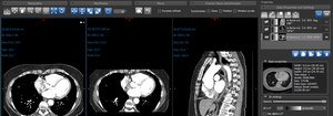 DICOM-Medical-Imaging-on-PinnacleWeekly