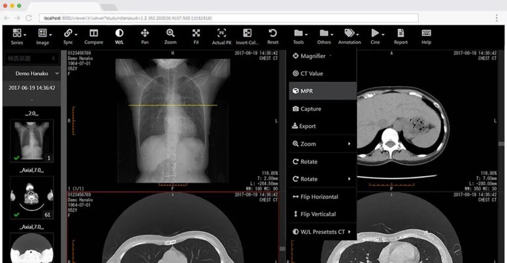 view DICOM images online